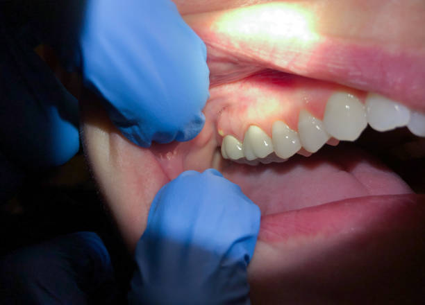 Best Broken or Chipped Tooth Repair in Leechburg, PA